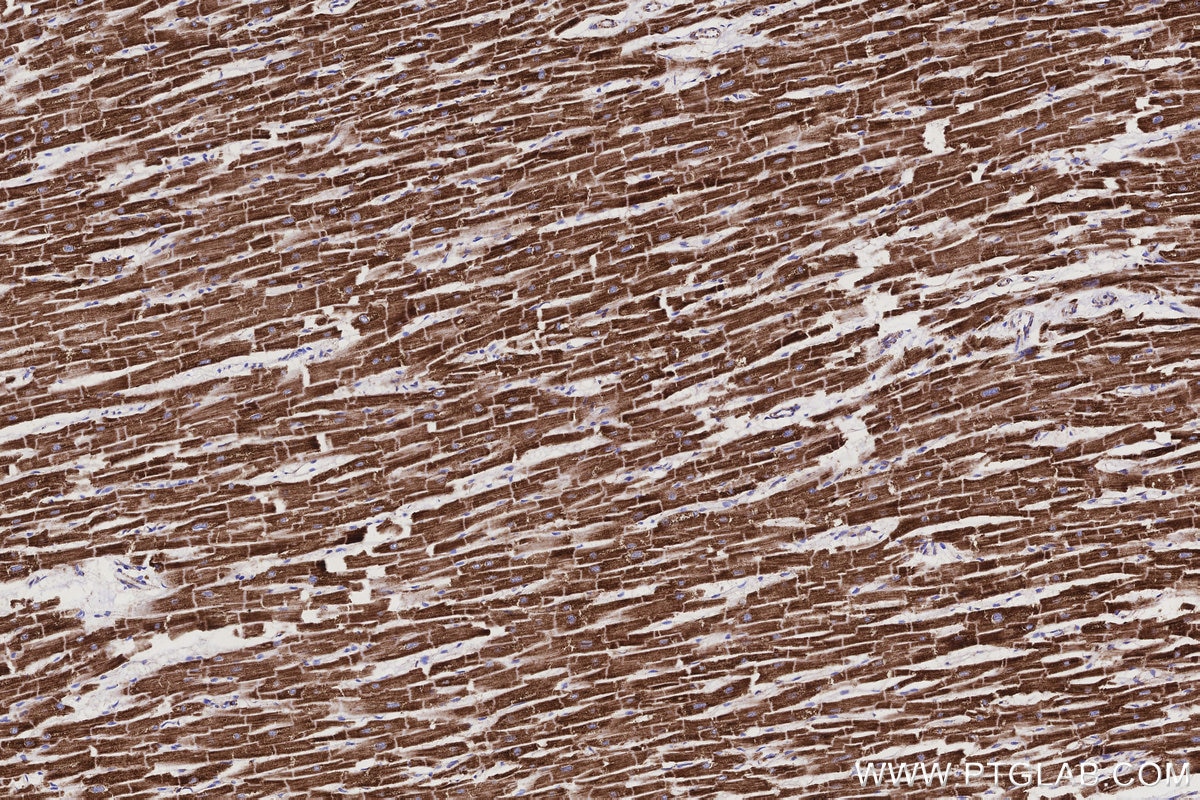 Immunohistochemical analysis of paraffin-embedded human heart tissue slide using KHC3158 (NDUFB10 IHC Kit).