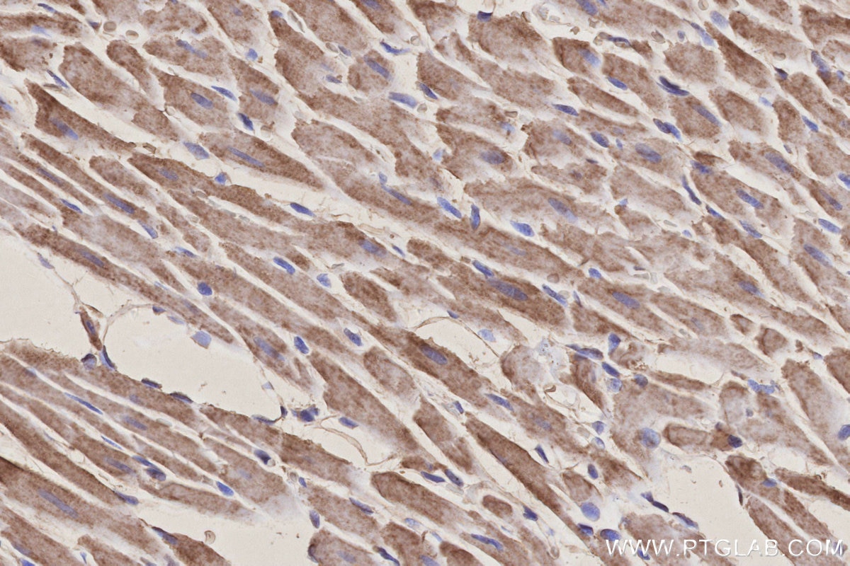 Immunohistochemical analysis of paraffin-embedded rat heart tissue slide using KHC3158 (NDUFB10 IHC Kit).