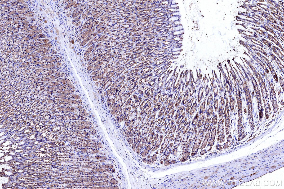 Immunohistochemical analysis of paraffin-embedded rat stomach tissue slide using KHC3144 (NDUFB5 IHC Kit).