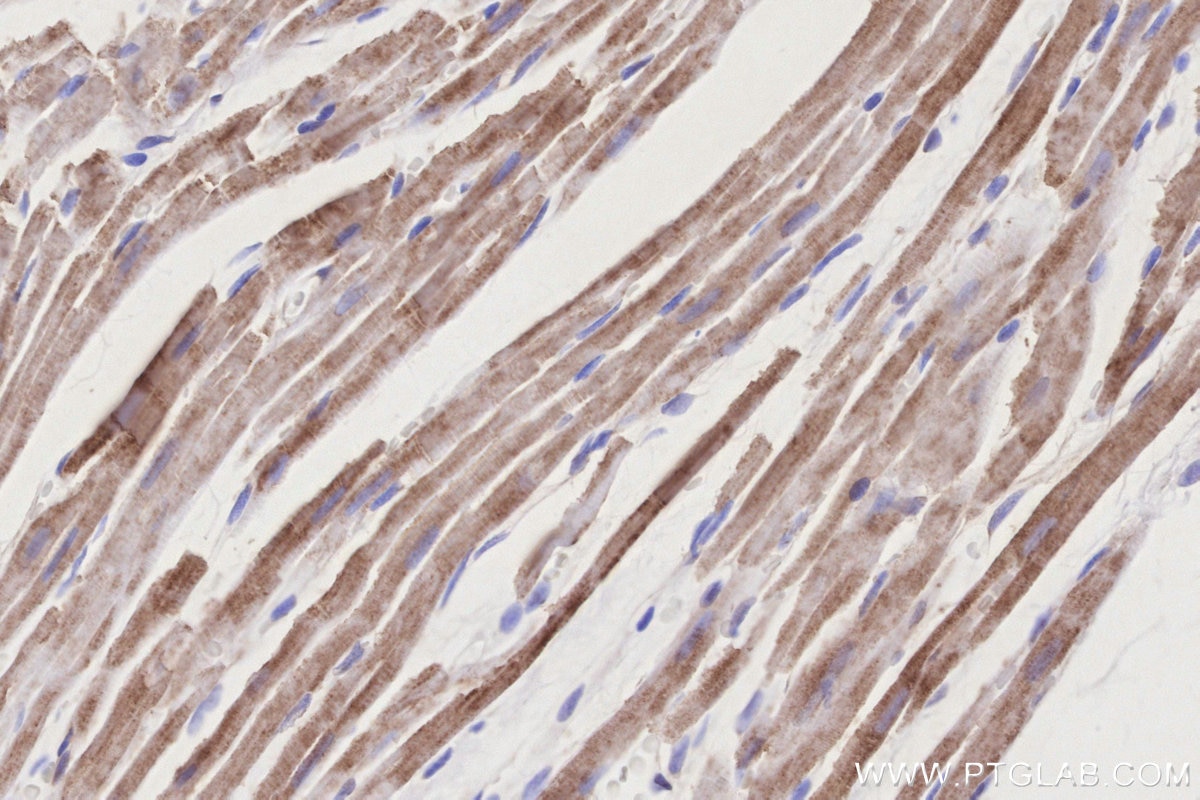 Immunohistochemical analysis of paraffin-embedded rat heart tissue slide using KHC3193 (NDUFB7 IHC Kit). Immunohistochemical analysis of paraffin-embedded rat heart tissue slide using KHC3193 (NDUFB7 IHC Kit).