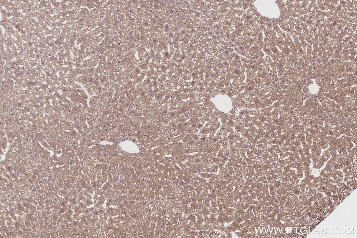Immunohistochemical analysis of paraffin-embedded mouse liver tissue slide using KHC3193 (NDUFB7 IHC Kit). Immunohistochemical analysis of paraffin-embedded mouse liver tissue slide using KHC3193 (NDUFB7 IHC Kit).