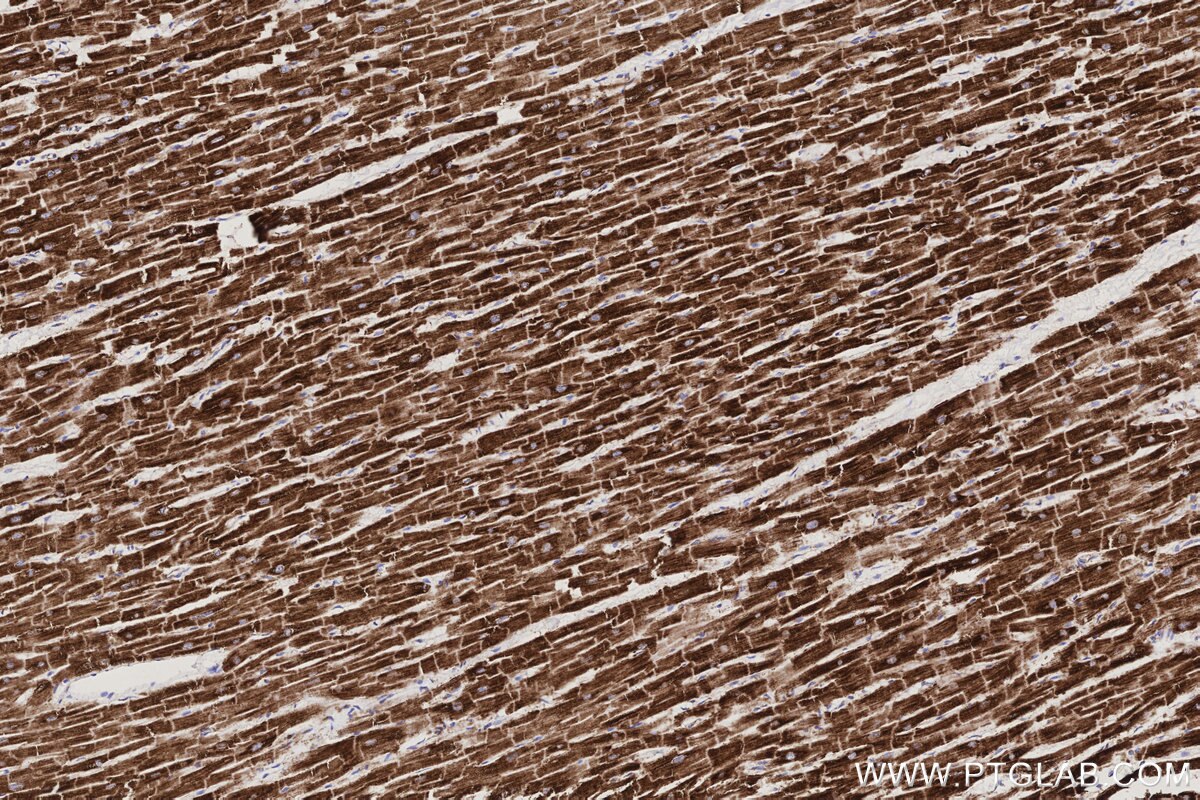 Immunohistochemical analysis of paraffin-embedded human heart tissue slide using KHC3193 (NDUFB7 IHC Kit). Immunohistochemical analysis of paraffin-embedded human heart tissue slide using KHC3193 (NDUFB7 IHC Kit).