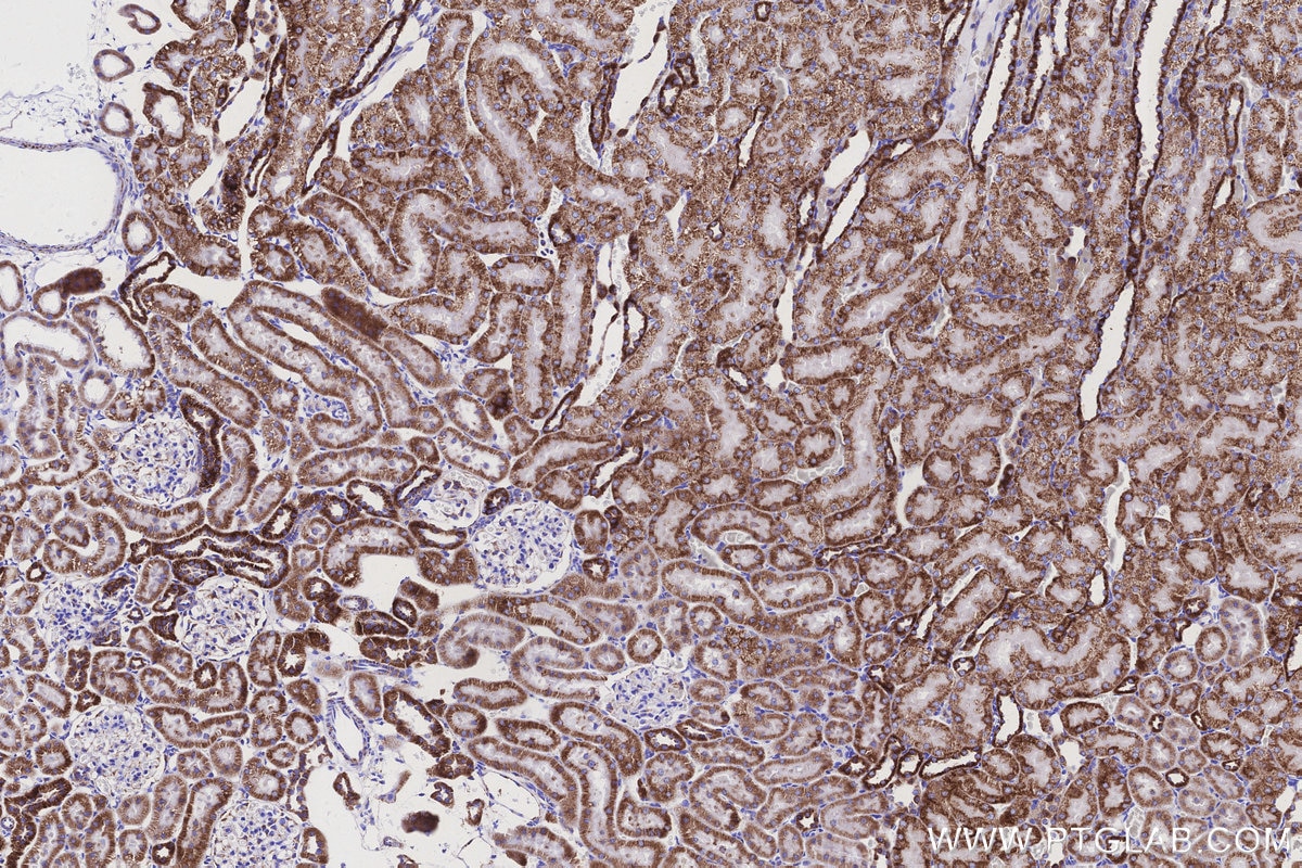 Immunohistochemical analysis of paraffin-embedded rat kidney tissue slide using KHC3154 (NDUFB8 IHC Kit).