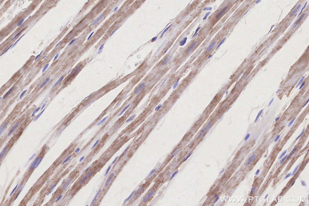 Immunohistochemical analysis of paraffin-embedded rat heart tissue slide using KHC3242 (NDUFS1 IHC Kit). Immunohistochemical analysis of paraffin-embedded rat heart tissue slide using KHC3242 (NDUFS1 IHC Kit).