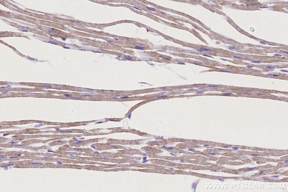 Immunohistochemical analysis of paraffin-embedded mouse heart tissue slide using KHC3242 (NDUFS1 IHC Kit). Immunohistochemical analysis of paraffin-embedded mouse heart tissue slide using KHC3242 (NDUFS1 IHC Kit).