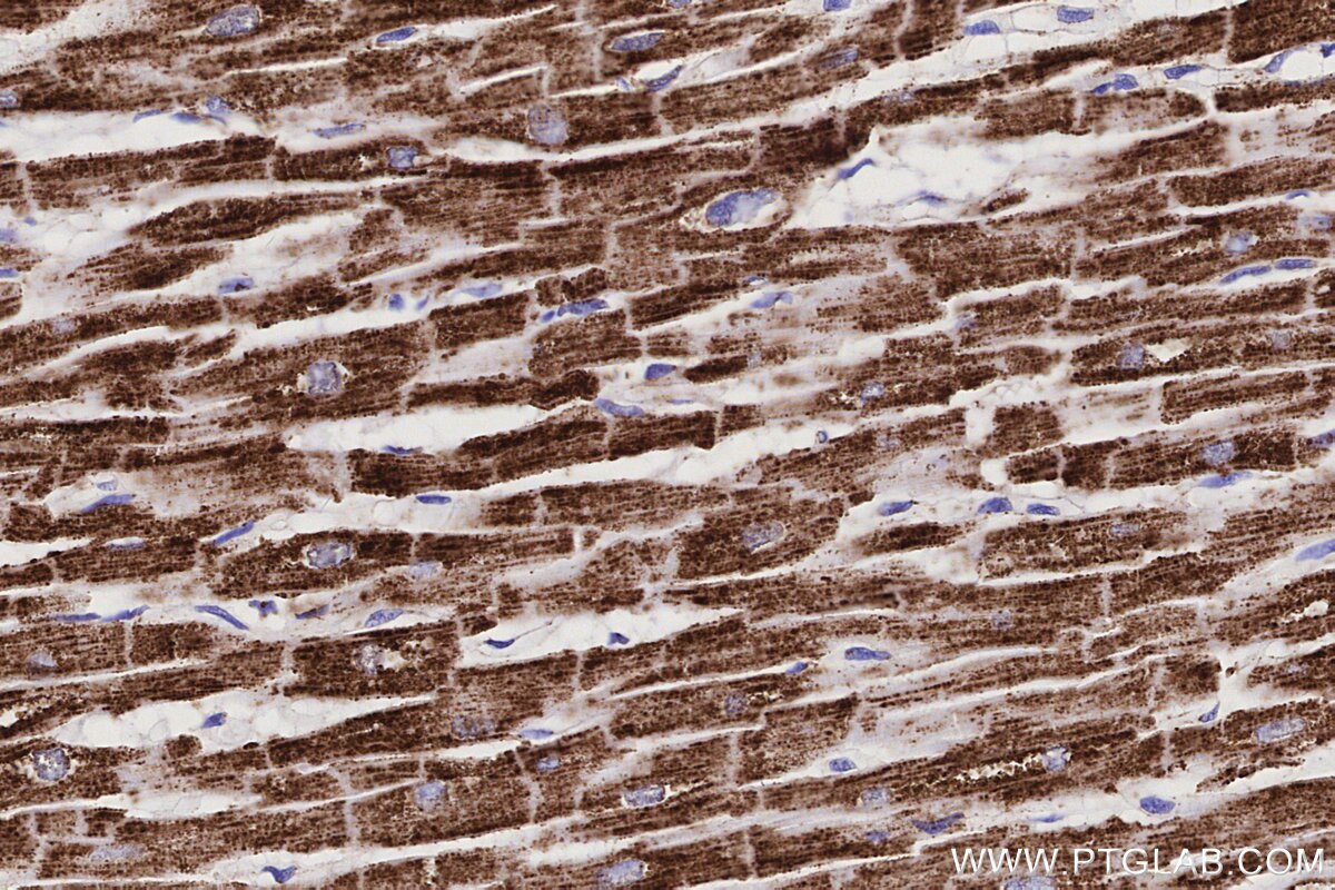 Immunohistochemical analysis of paraffin-embedded human heart tissue slide using KHC3242 (NDUFS1 IHC Kit). Immunohistochemical analysis of paraffin-embedded human heart tissue slide using KHC3242 (NDUFS1 IHC Kit).