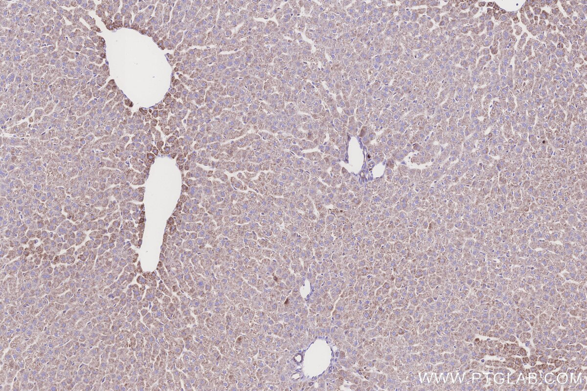Immunohistochemical analysis of paraffin-embedded rat liver tissue slide using KHC3242 (NDUFS1 IHC Kit). Immunohistochemical analysis of paraffin-embedded rat liver tissue slide using KHC3242 (NDUFS1 IHC Kit).