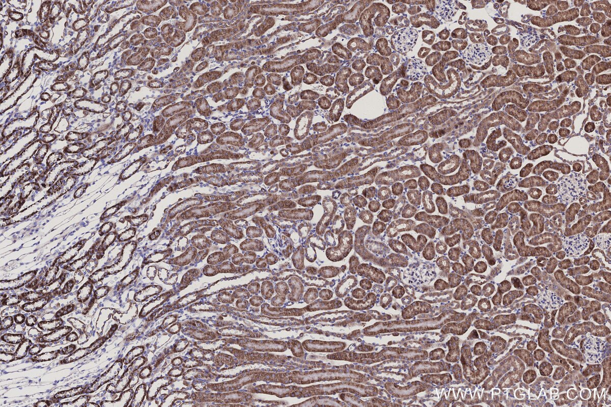Immunohistochemical analysis of paraffin-embedded mouse kidney tissue slide using KHC3149 (NDUFS2 IHC Kit). Immunohistochemical analysis of paraffin-embedded mouse kidney tissue slide using KHC3149 (NDUFS2 IHC Kit).