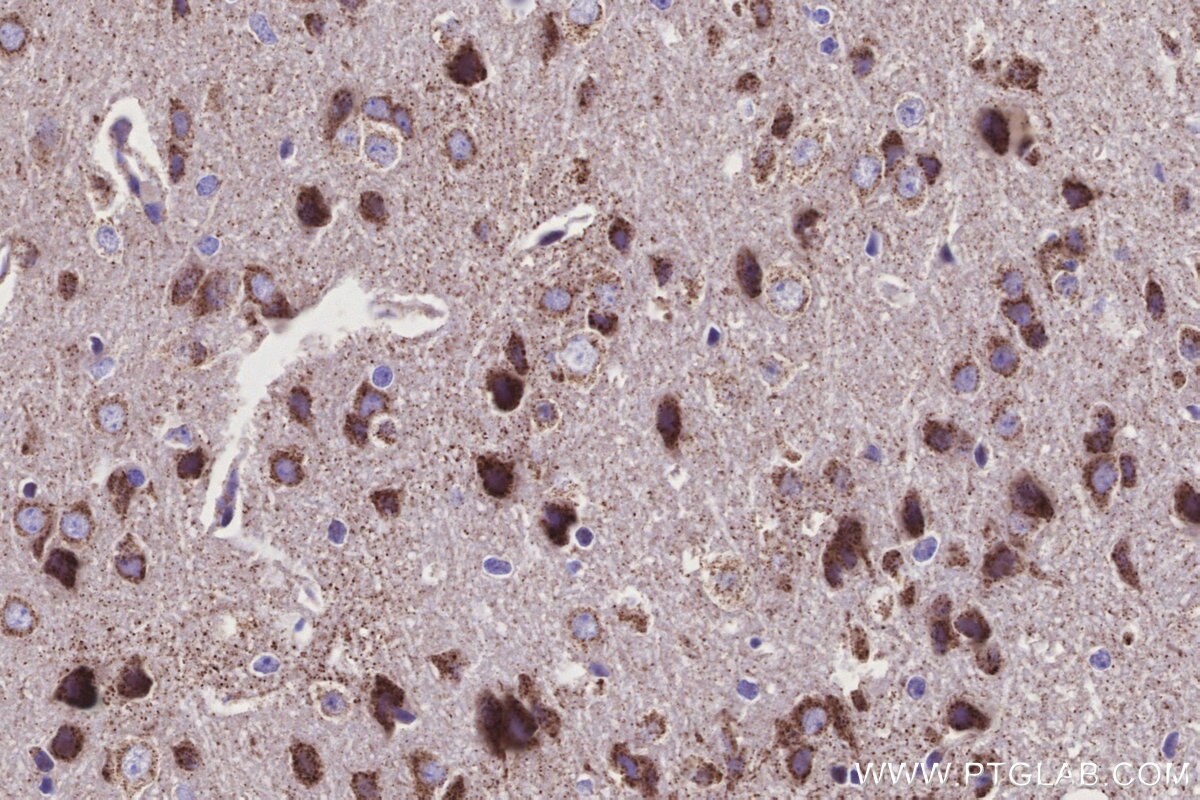 Immunohistochemical analysis of paraffin-embedded mouse brain tissue slide using KHC3149 (NDUFS2 IHC Kit). Immunohistochemical analysis of paraffin-embedded mouse brain tissue slide using KHC3149 (NDUFS2 IHC Kit).