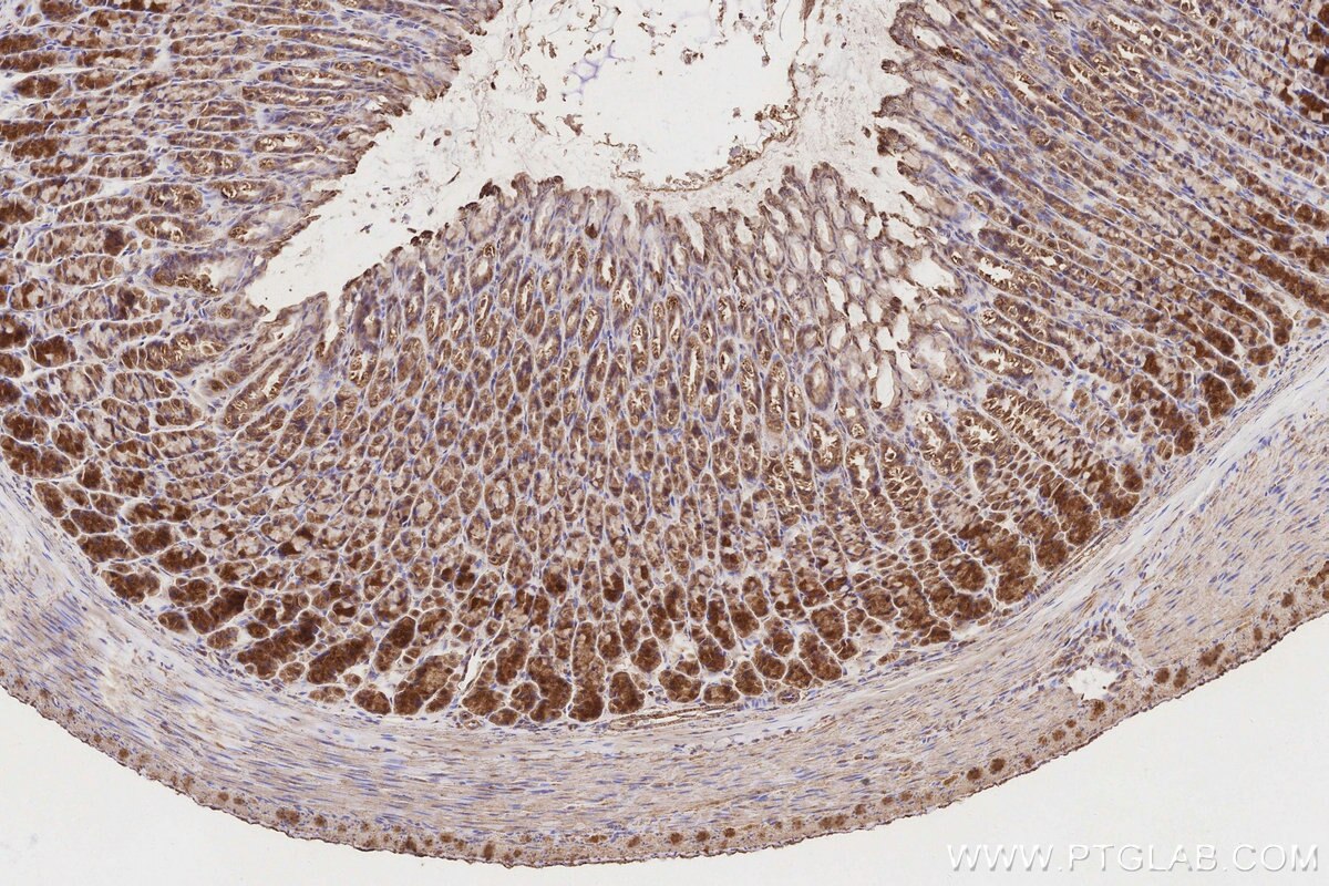 Immunohistochemical analysis of paraffin-embedded rat stomach tissue slide using KHC3149 (NDUFS2 IHC Kit). Immunohistochemical analysis of paraffin-embedded rat stomach tissue slide using KHC3149 (NDUFS2 IHC Kit).