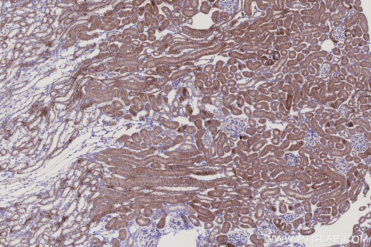 Immunohistochemical analysis of paraffin-embedded mouse kidney tissue slide using KHC3146 (NDUFS5 IHC Kit).