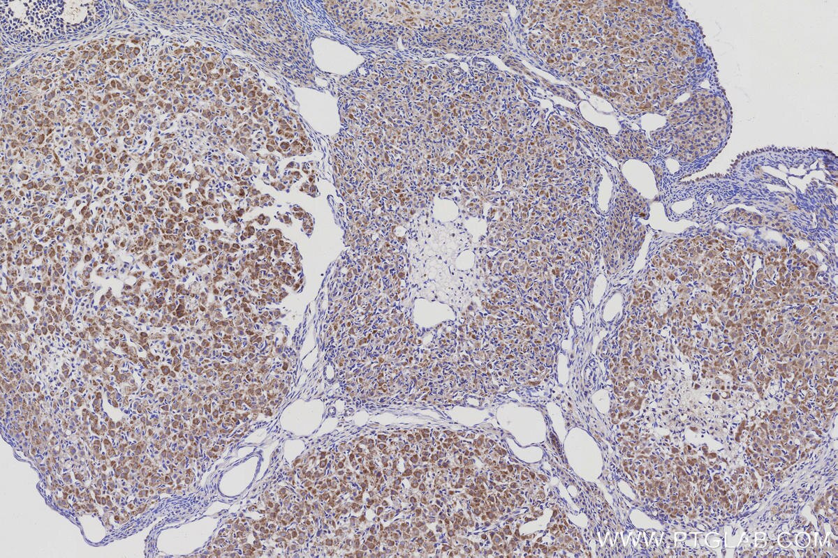 Immunohistochemical analysis of paraffin-embedded rat ovary tissue slide using KHC3146 (NDUFS5 IHC Kit).