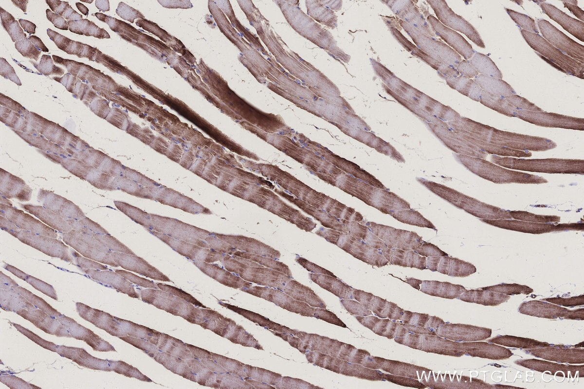 Immunohistochemical analysis of paraffin-embedded mouse skeletal muscle tissue slide using KHC3150 (NDUFS6 IHC Kit).