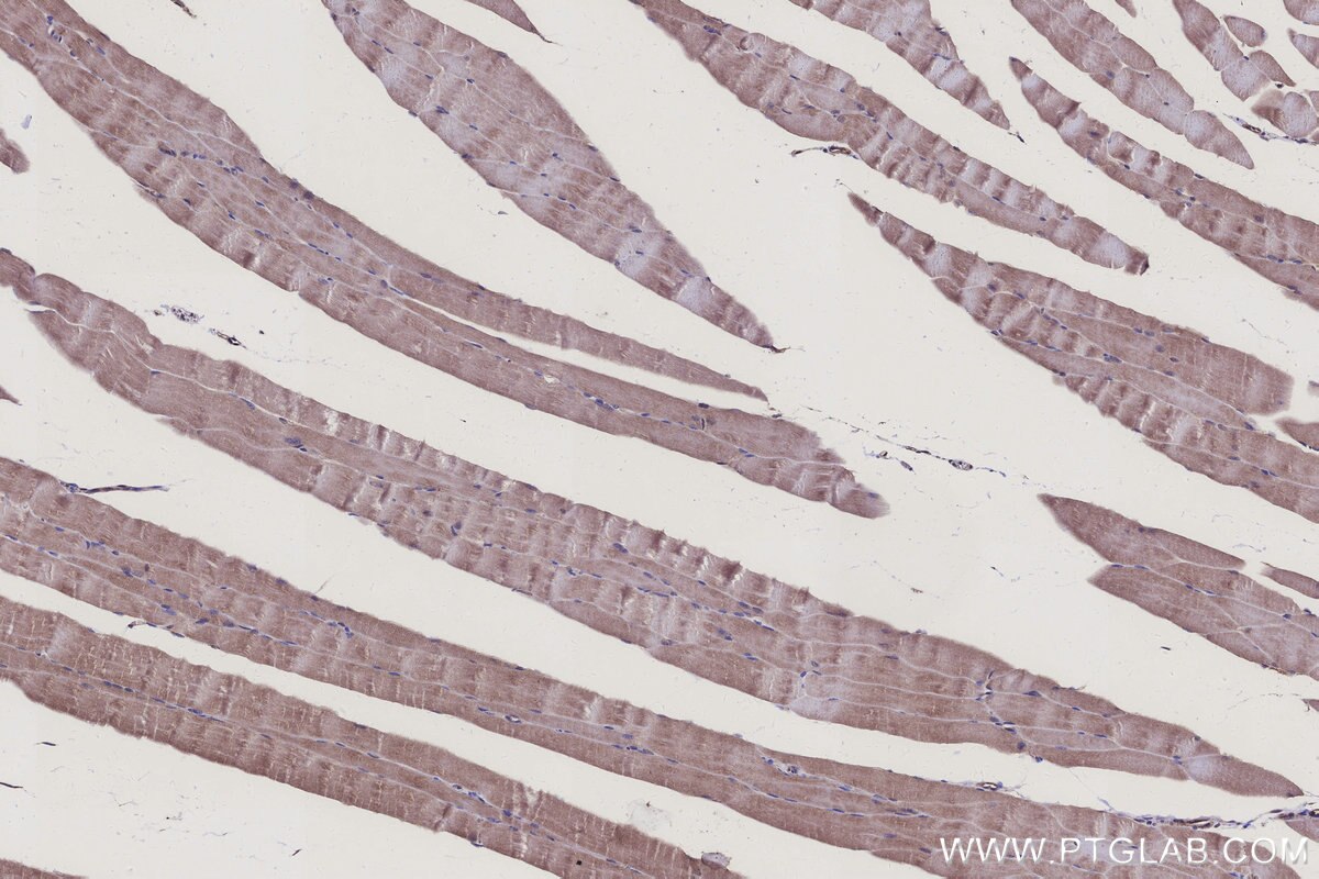 Immunohistochemical analysis of paraffin-embedded mouse skeletal muscle tissue slide using KHC3178 (NDUFS7 IHC Kit).
