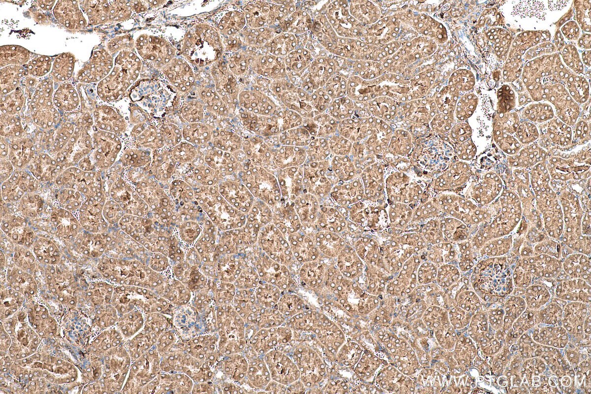 Immunohistochemical analysis of paraffin-embedded mouse kidney tissue slide using KHC0633 (NDUFV1 IHC Kit).