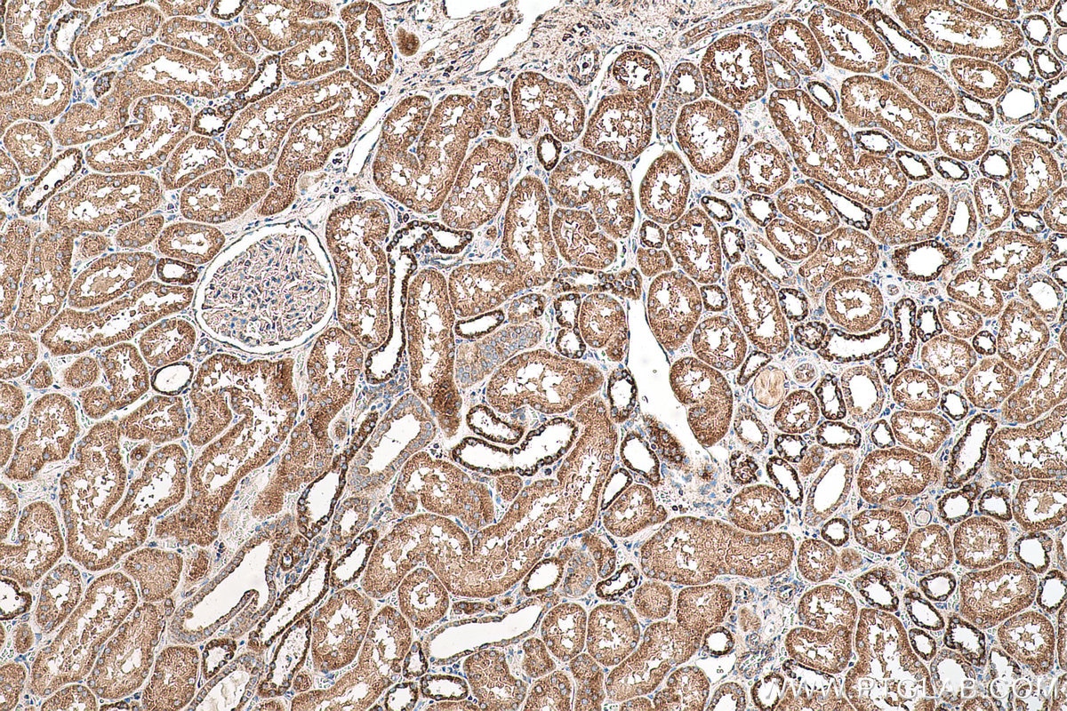 Immunohistochemical analysis of paraffin-embedded human kidney tissue slide using KHC0633 (NDUFV1 IHC Kit).