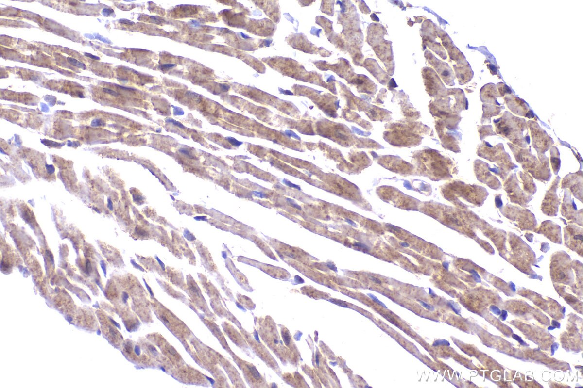 Immunohistochemical analysis of paraffin-embedded mouse heart tissue slide using KHC2329 (NDUFV3 IHC Kit).