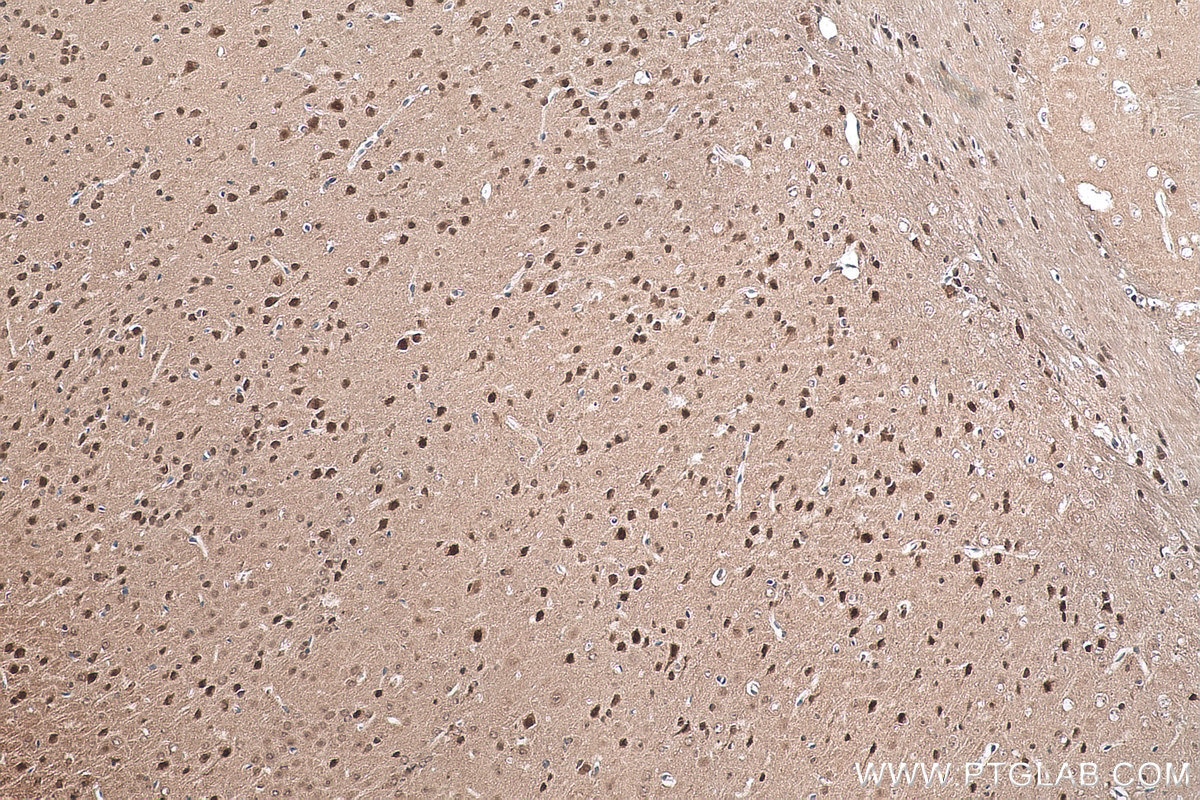 Immunohistochemical analysis of paraffin-embedded mouse brain tissue slide using KHC0901 (NEDD8 IHC Kit).