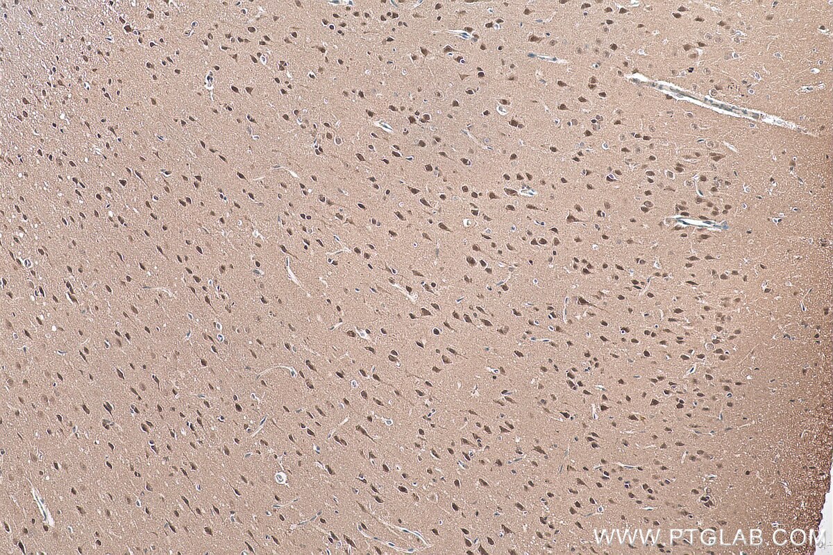 Immunohistochemical analysis of paraffin-embedded rat brain tissue slide using KHC0901 (NEDD8 IHC Kit).