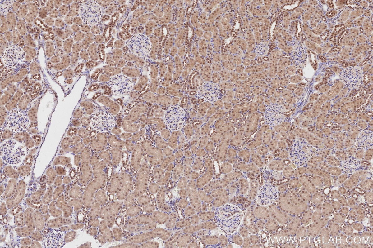 Immunohistochemical analysis of paraffin-embedded rat kidney tissue slide using KHC2817 (NEK1 IHC Kit).