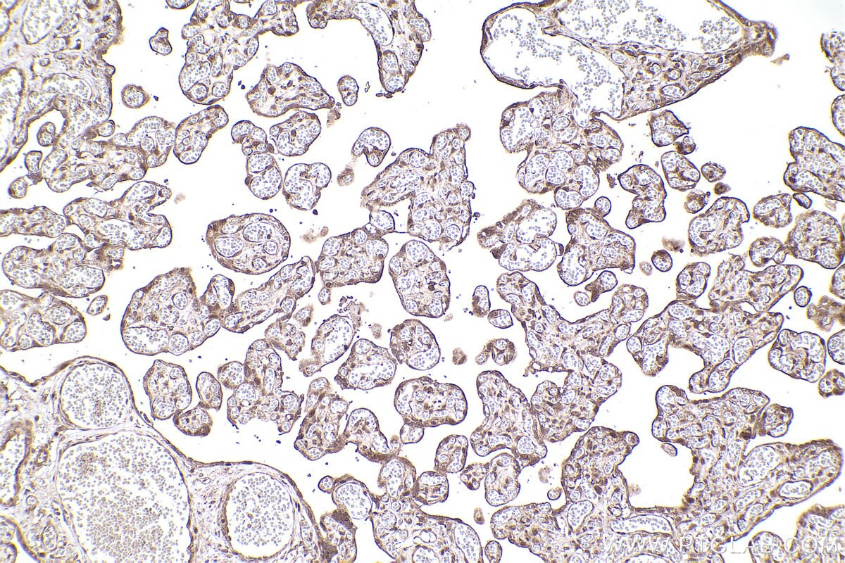Immunohistochemical analysis of paraffin-embedded human placenta tissue slide using KHC2308 (NEK4 IHC Kit).