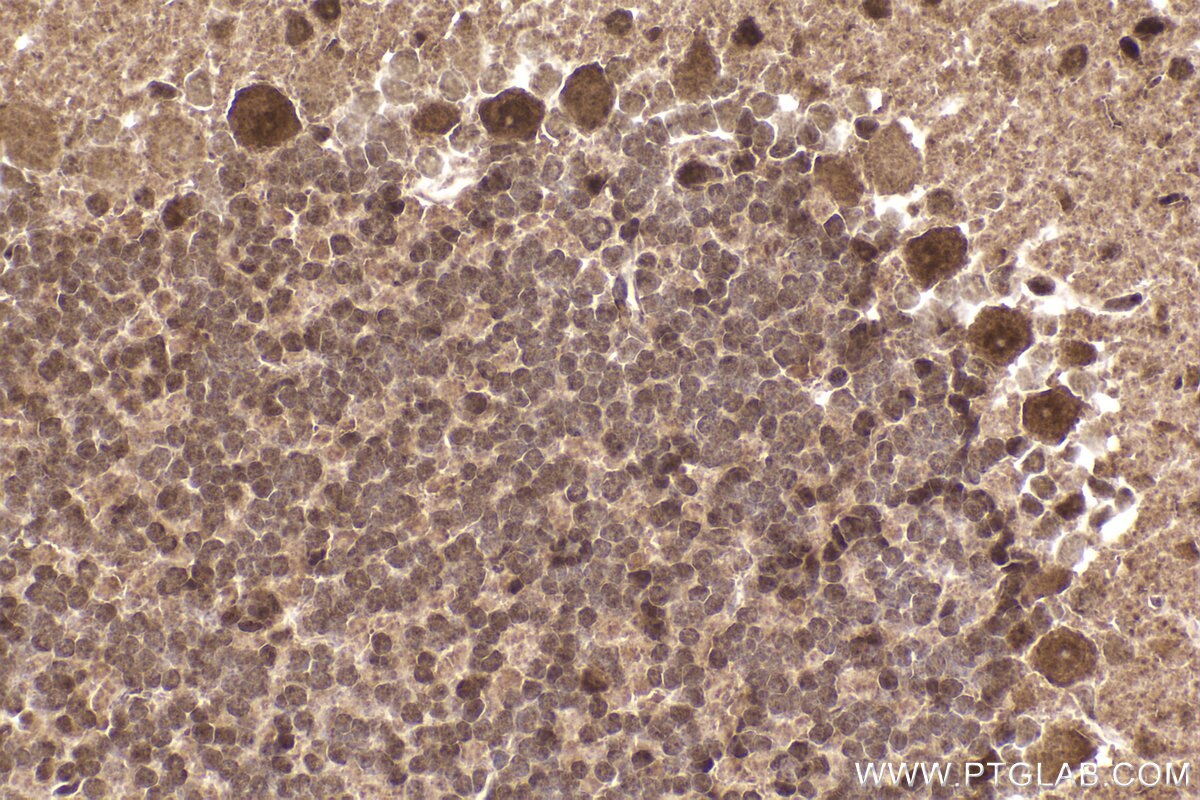 Immunohistochemical analysis of paraffin-embedded mouse cerebellum tissue slide using KHC2308 (NEK4 IHC Kit).