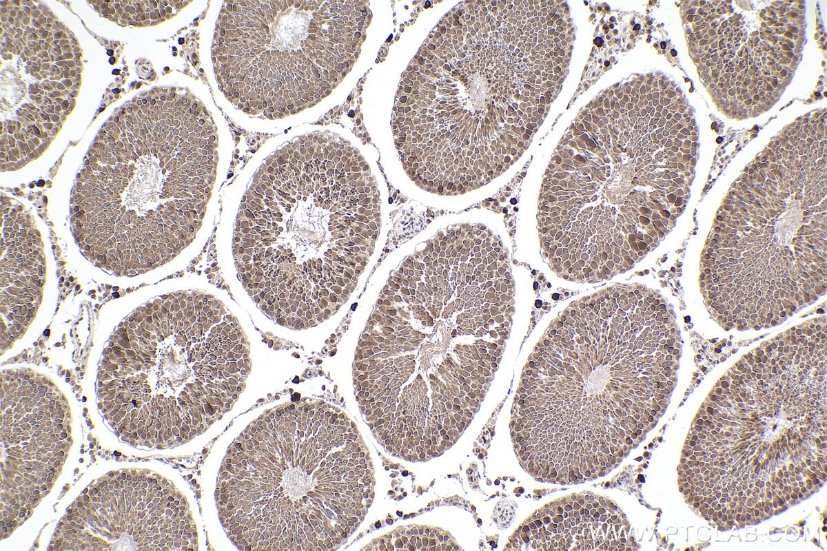 Immunohistochemical analysis of paraffin-embedded rat testis tissue slide using KHC2308 (NEK4 IHC Kit).