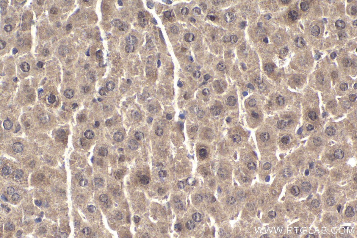 Immunohistochemical analysis of paraffin-embedded mouse liver tissue slide using KHC1945 (NEK6 IHC Kit).