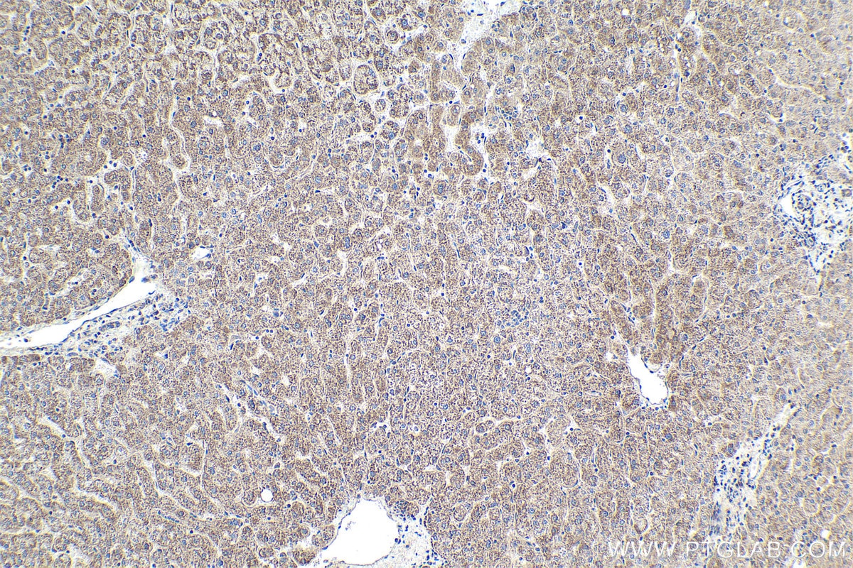 Immunohistochemical analysis of paraffin-embedded human liver tissue slide using KHC1945 (NEK6 IHC Kit).