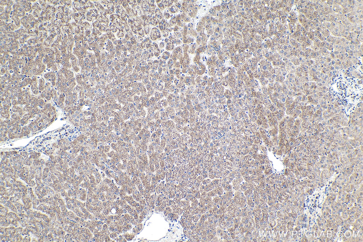 Immunohistochemical analysis of paraffin-embedded human liver tissue slide using KHC1945 (NEK6 IHC Kit).