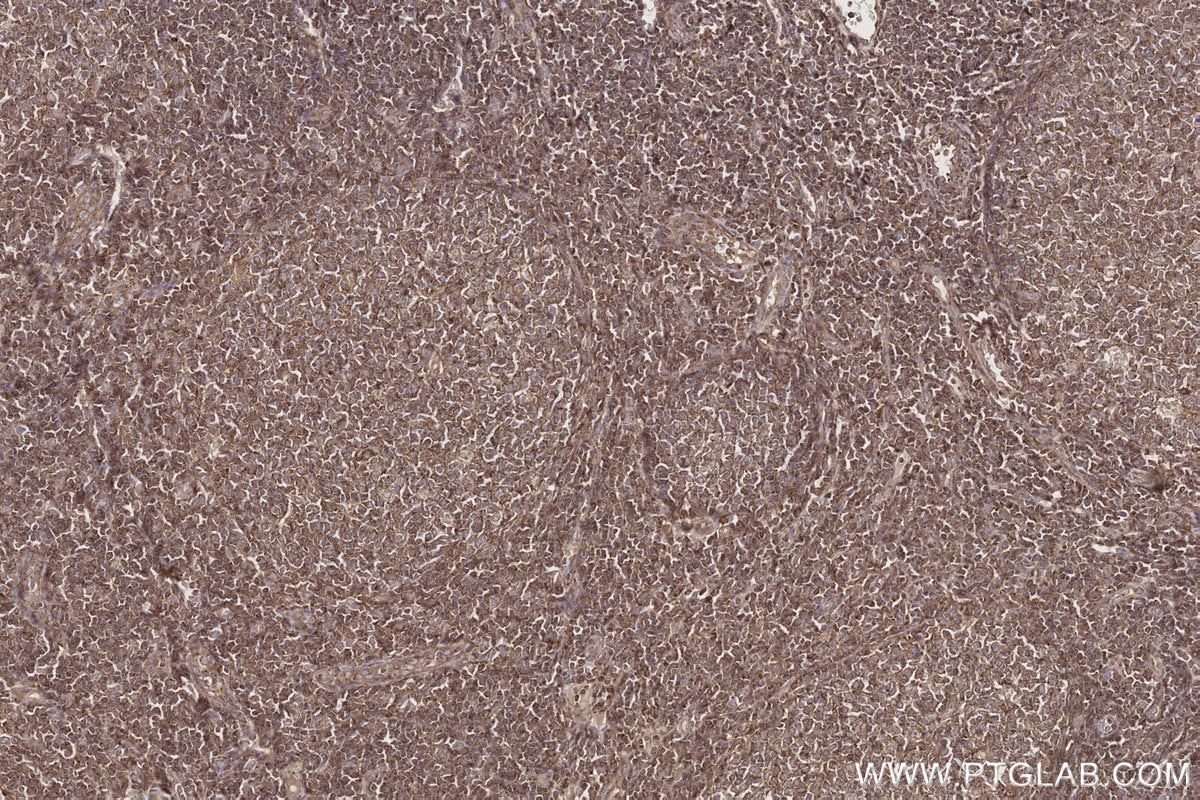 Immunohistochemical analysis of paraffin-embedded human tonsillitis tissue slide using KHC2716 (NEK9 IHC Kit).
