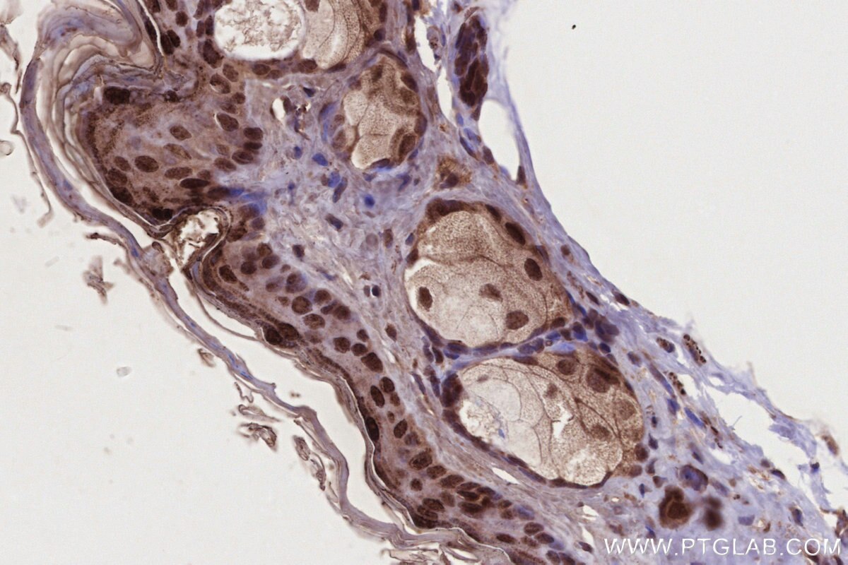 Immunohistochemical analysis of paraffin-embedded mouse skin tissue slide using KHC2716 (NEK9 IHC Kit).