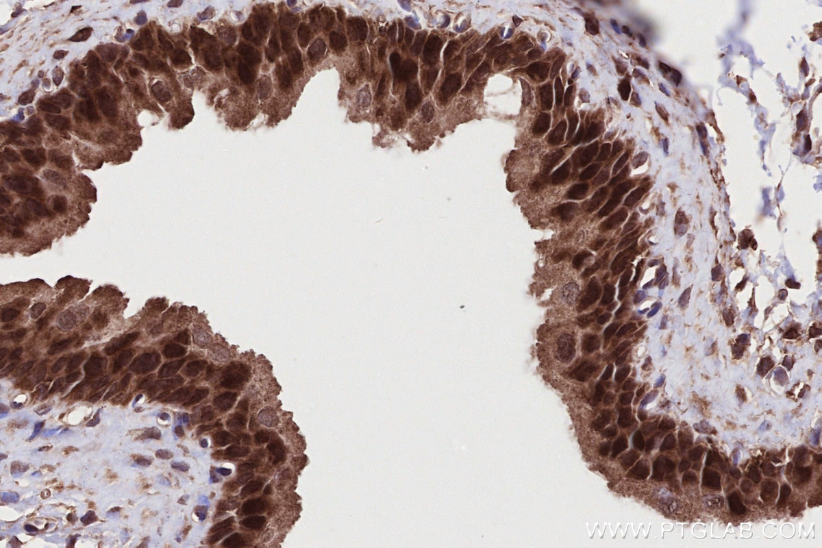 Immunohistochemical analysis of paraffin-embedded rat bladder tissue slide using KHC2716 (NEK9 IHC Kit).