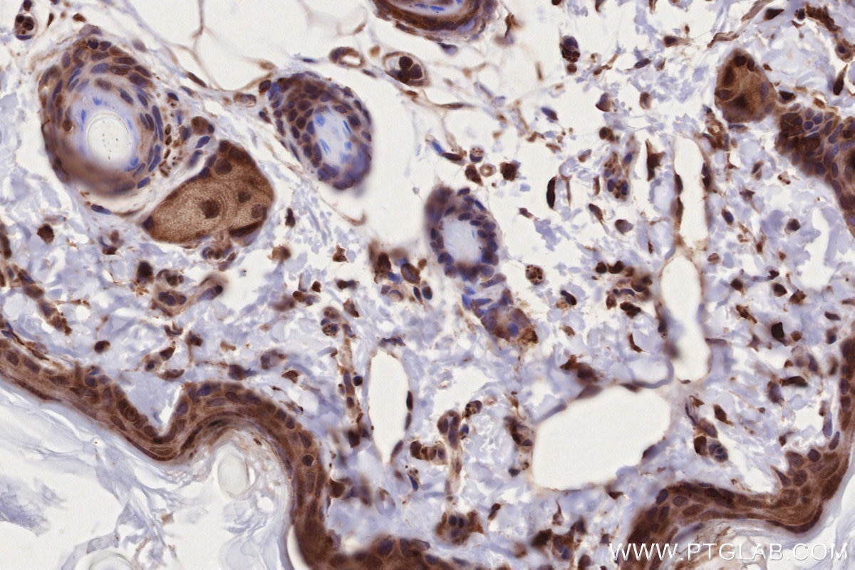 Immunohistochemical analysis of paraffin-embedded rat skin tissue slide using KHC2716 (NEK9 IHC Kit).