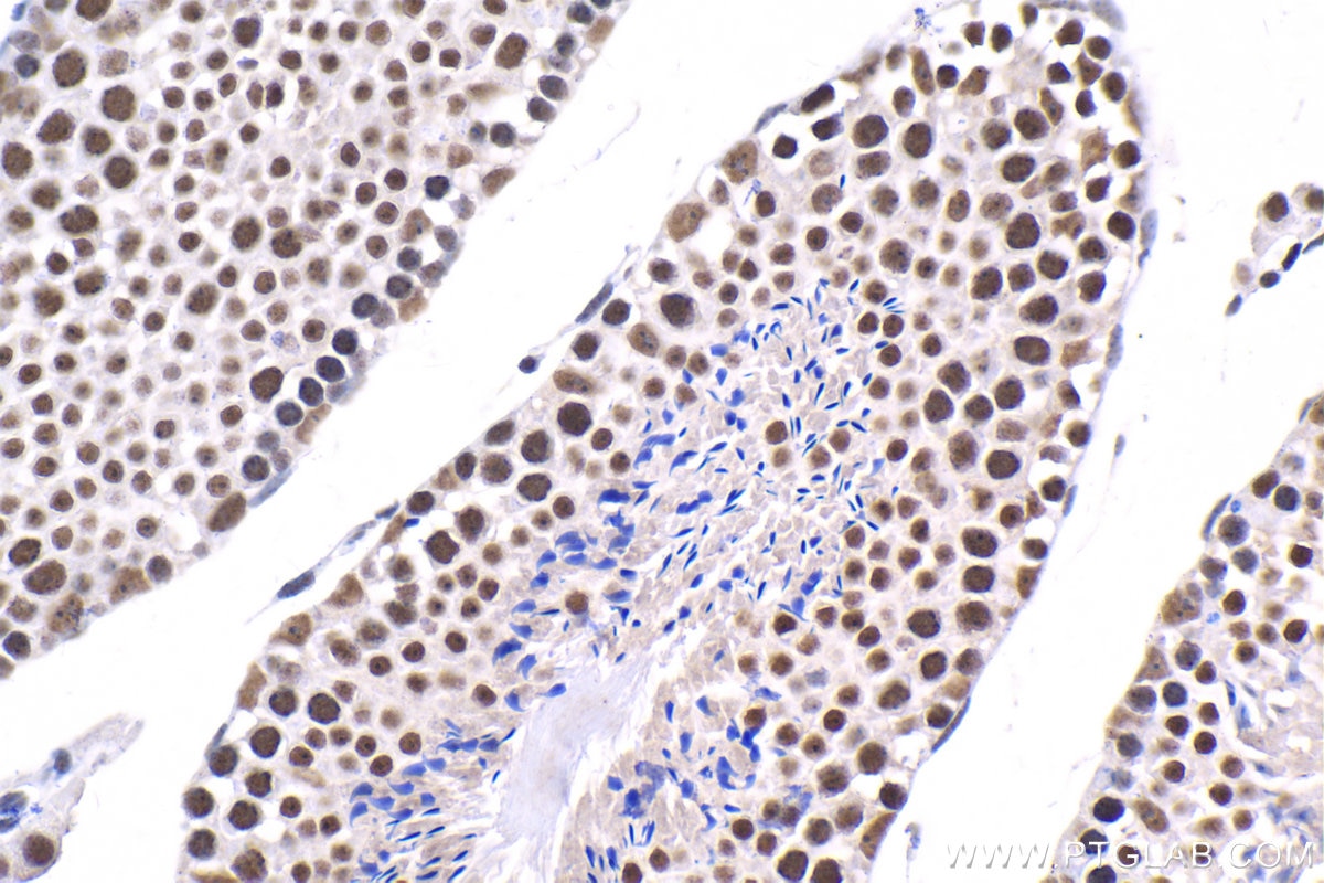 Immunohistochemical analysis of paraffin-embedded mouse testis tissue slide using KHC1542 (NELFE IHC Kit).