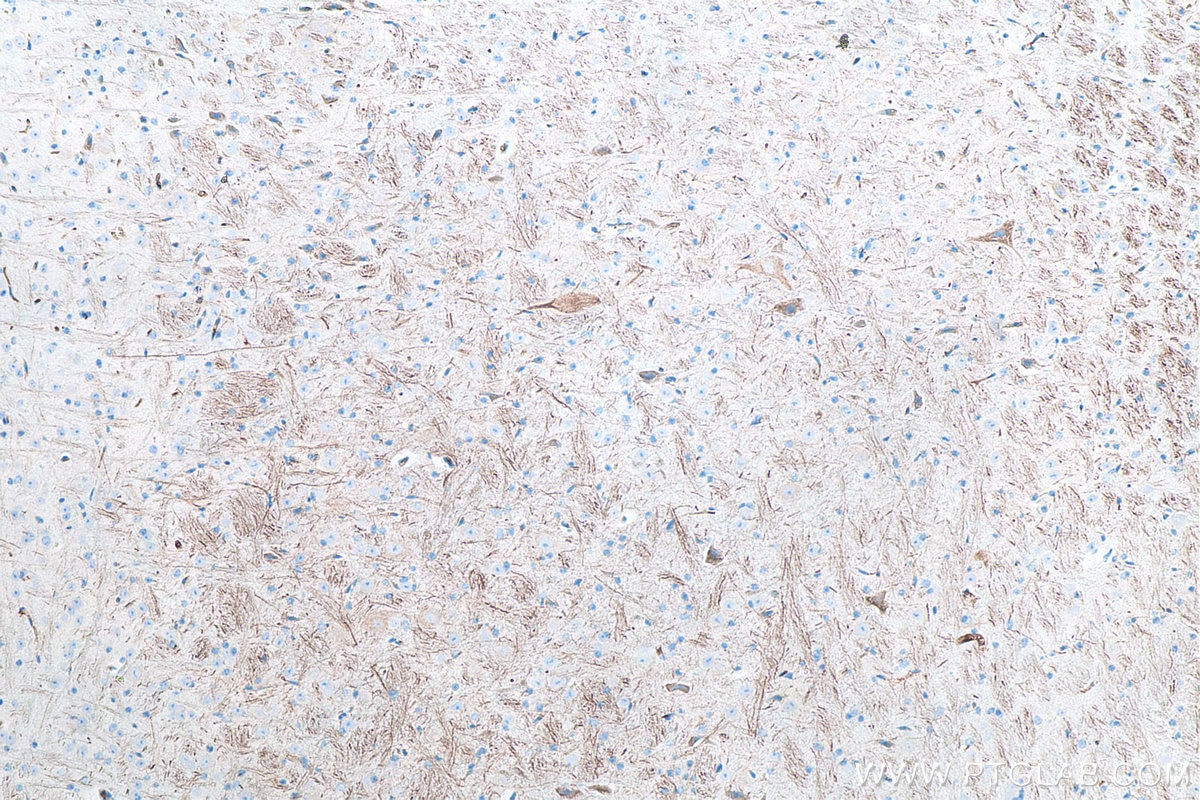 Immunohistochemical analysis of paraffin-embedded mouse cerebellum tissue slide using KHC0046 (NF-H/NF200 IHC Kit).