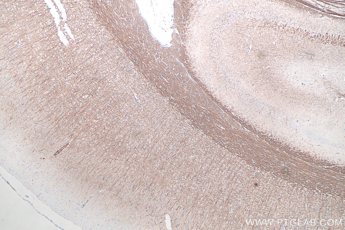 Immunohistochemical analysis of paraffin-embedded rat brain tissue slide using KHC0045 (NF-M IHC Kit).