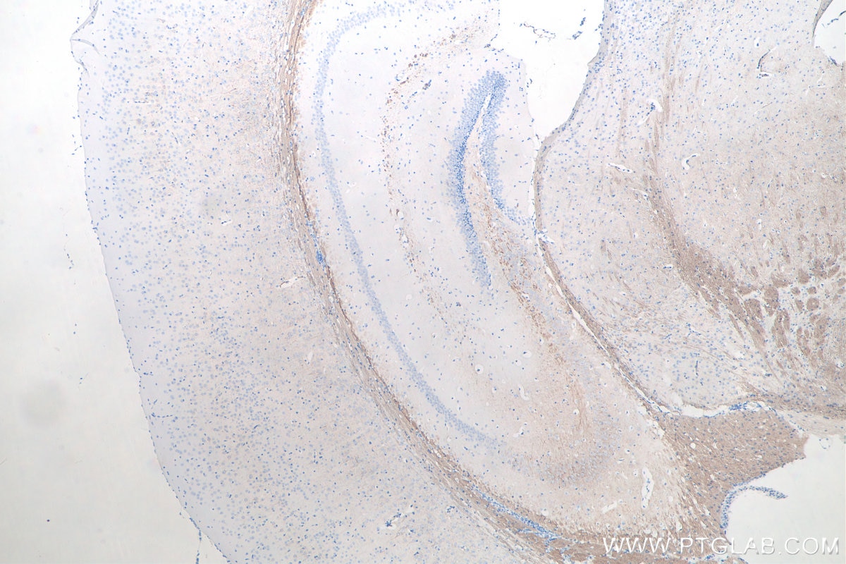 Immunohistochemical analysis of paraffin-embedded mouse brain tissue slide using KHC0045 (NF-M IHC Kit).