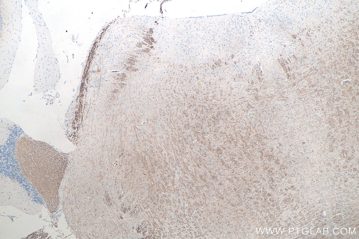 Immunohistochemical analysis of paraffin-embedded mouse cerebellum tissue slide using KHC0045 (NF-M IHC Kit).