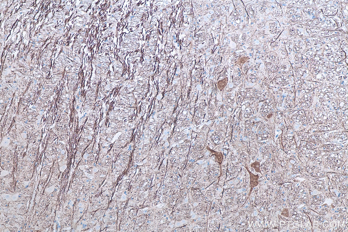 Immunohistochemical analysis of paraffin-embedded rat cerebellum tissue slide using KHC0045 (NF-M IHC Kit).