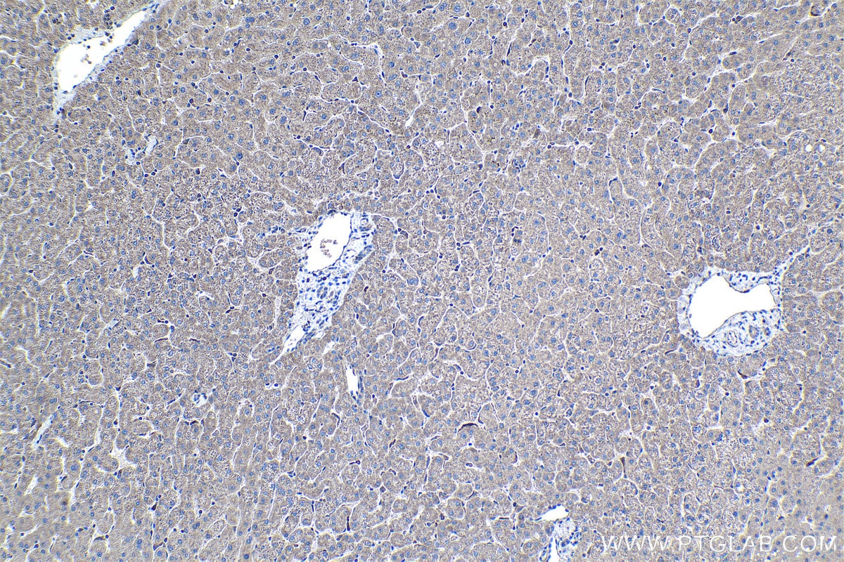 Immunohistochemical analysis of paraffin-embedded human liver tissue slide using KHC1057 (NF1 IHC Kit).