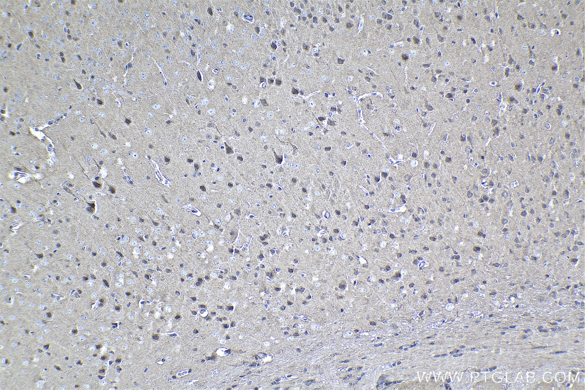 Immunohistochemical analysis of paraffin-embedded mouse brain tissue slide using KHC1057 (NF1 IHC Kit).