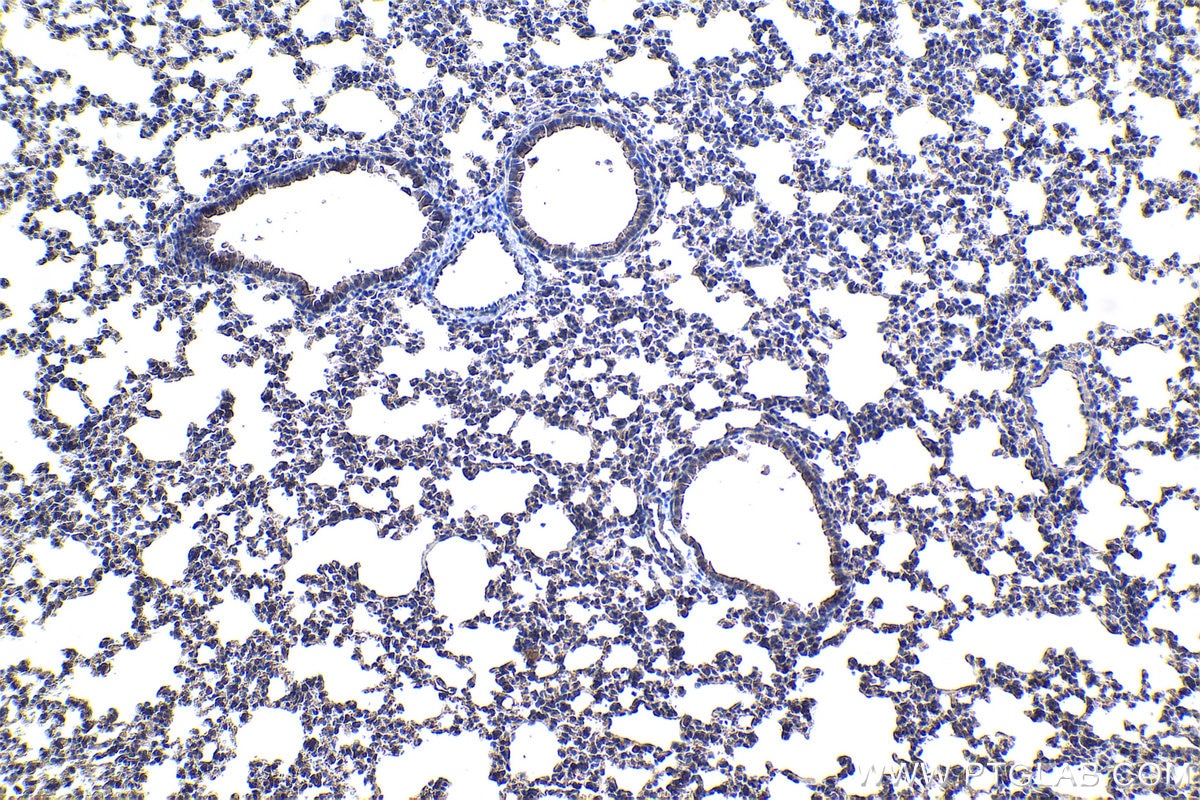Immunohistochemical analysis of paraffin-embedded mouse lung tissue slide using KHC1057 (NF1 IHC Kit).