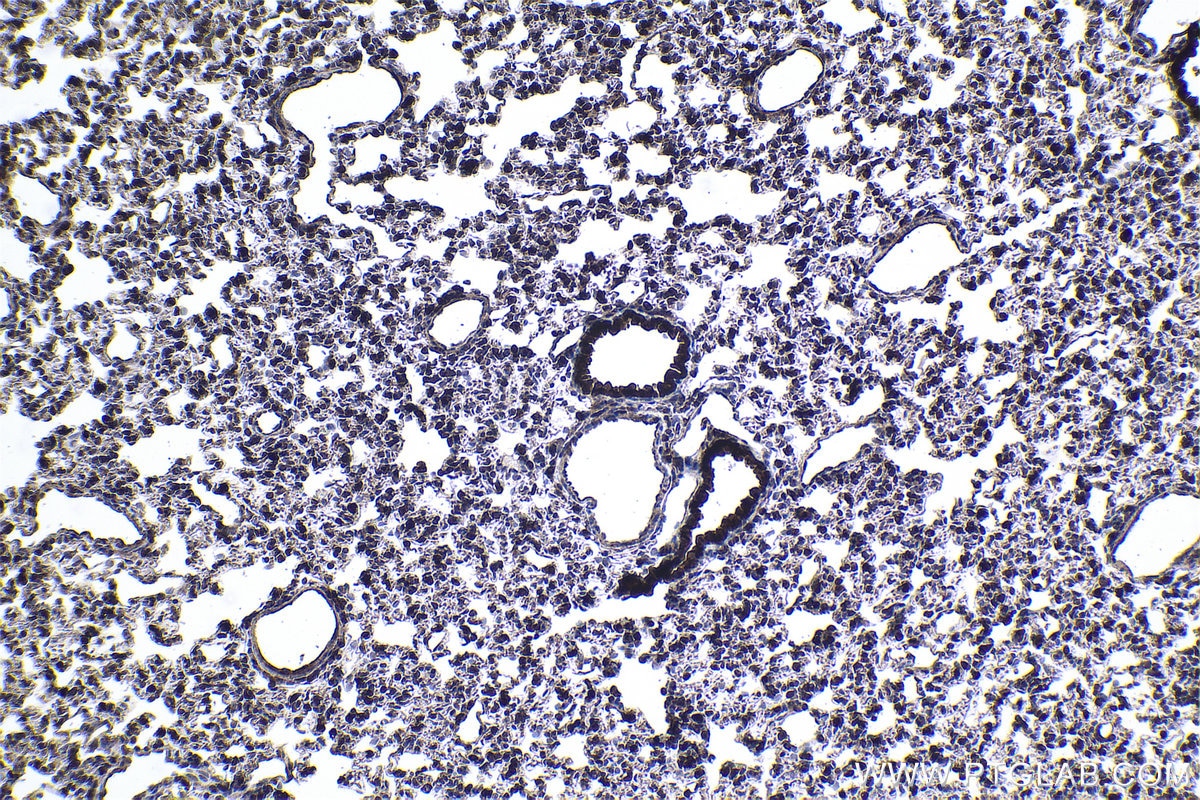 Immunohistochemical analysis of paraffin-embedded rat lung tissue slide using KHC1057 (NF1 IHC Kit).