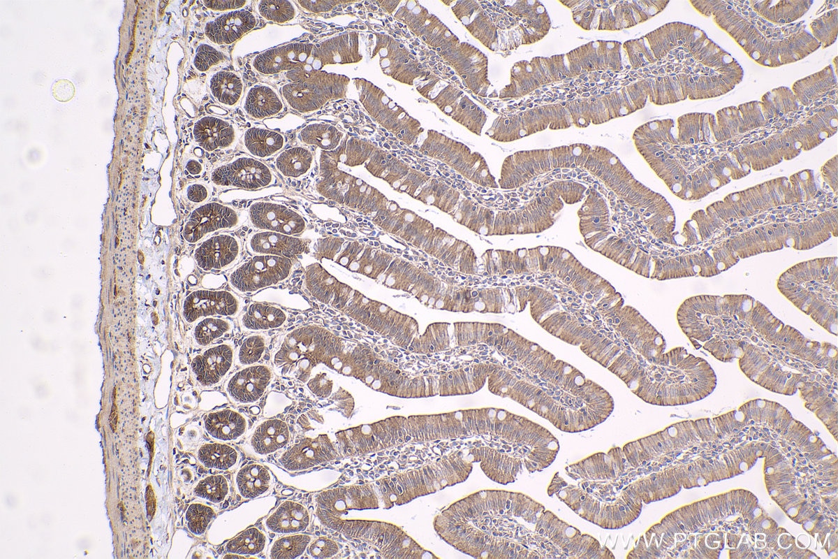 Immunohistochemical analysis of paraffin-embedded rat small intestine tissue slide using KHC1582 (NF2 IHC Kit).
