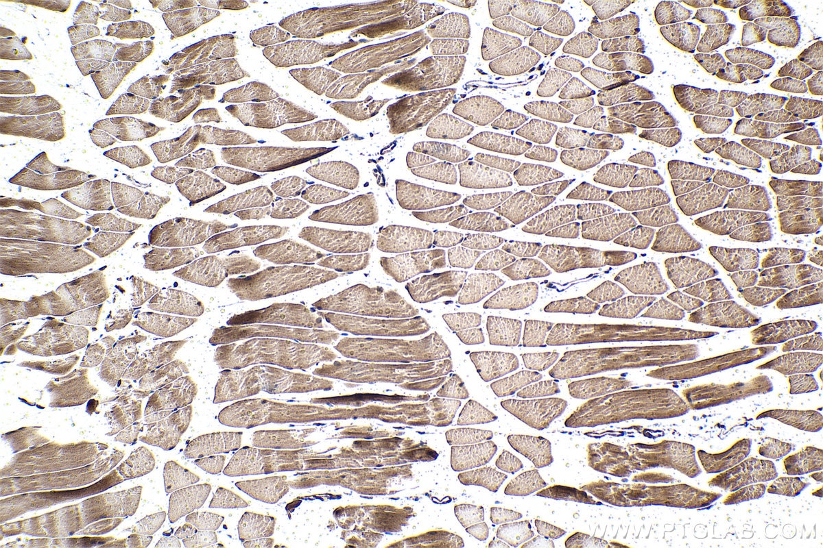 Immunohistochemical analysis of paraffin-embedded mouse skeletal muscle tissue slide using KHC1488 (NFAT5 IHC Kit).