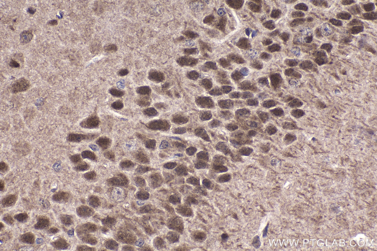 Immunohistochemical analysis of paraffin-embedded mouse brain tissue slide using KHC1488 (NFAT5 IHC Kit).