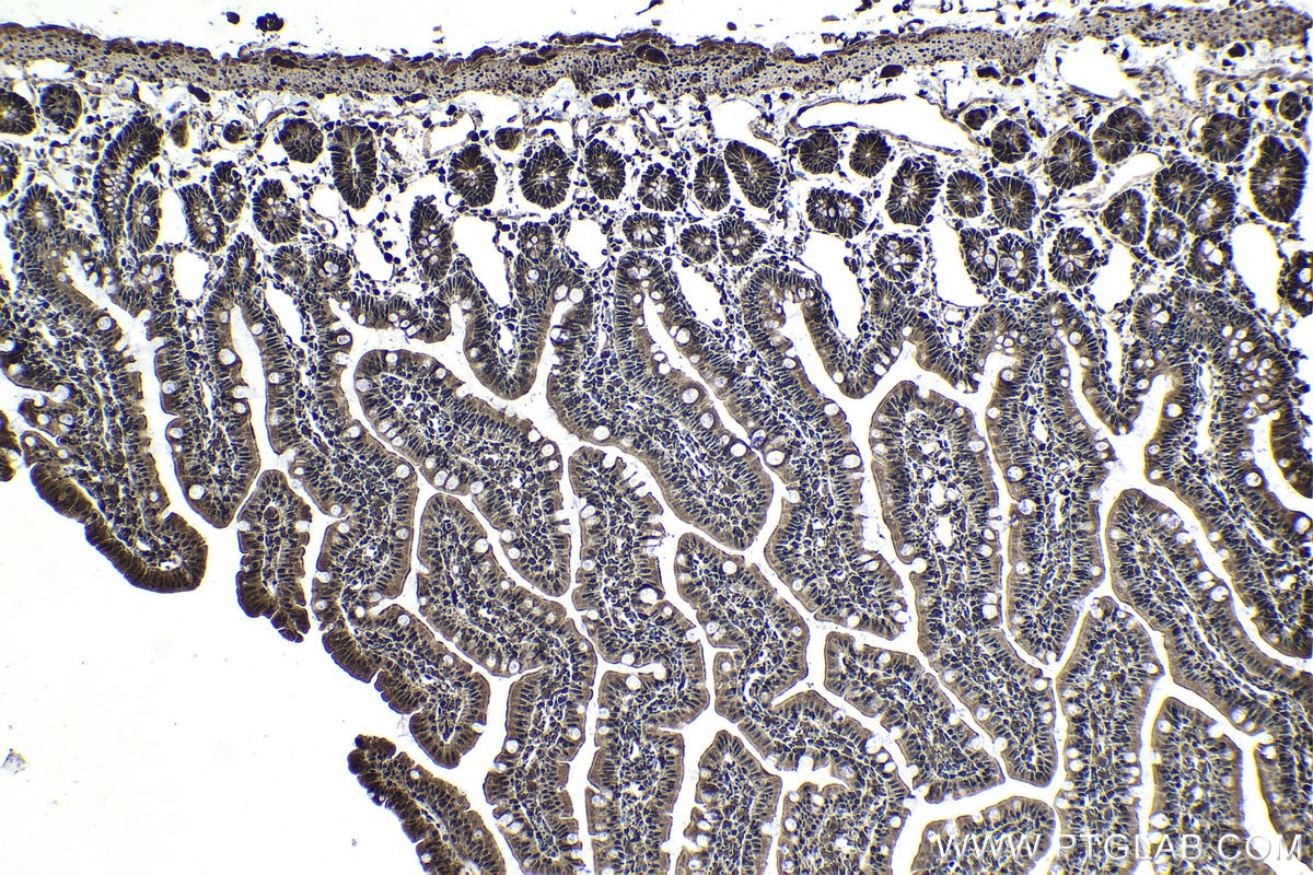 Immunohistochemical analysis of paraffin-embedded rat small intestine tissue slide using KHC1712 (NFATC2 IHC Kit).