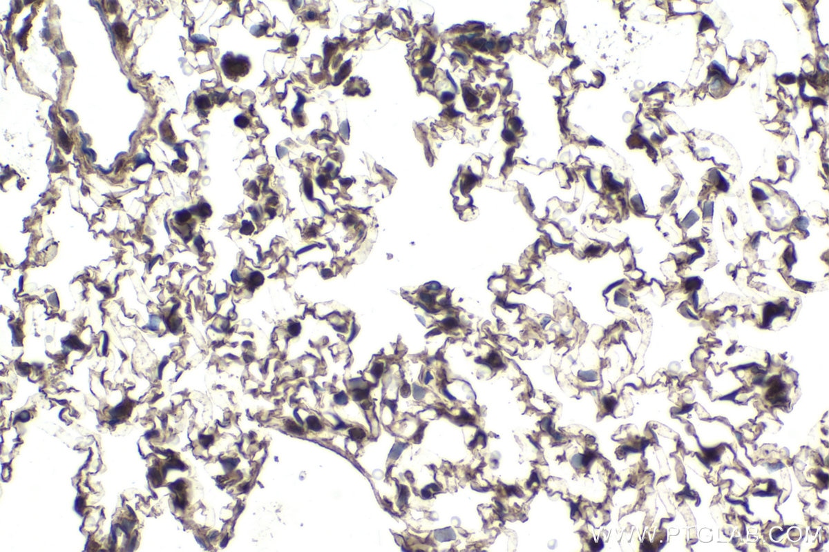 Immunohistochemical analysis of paraffin-embedded rat lung tissue slide using KHC1712 (NFATC2 IHC Kit).