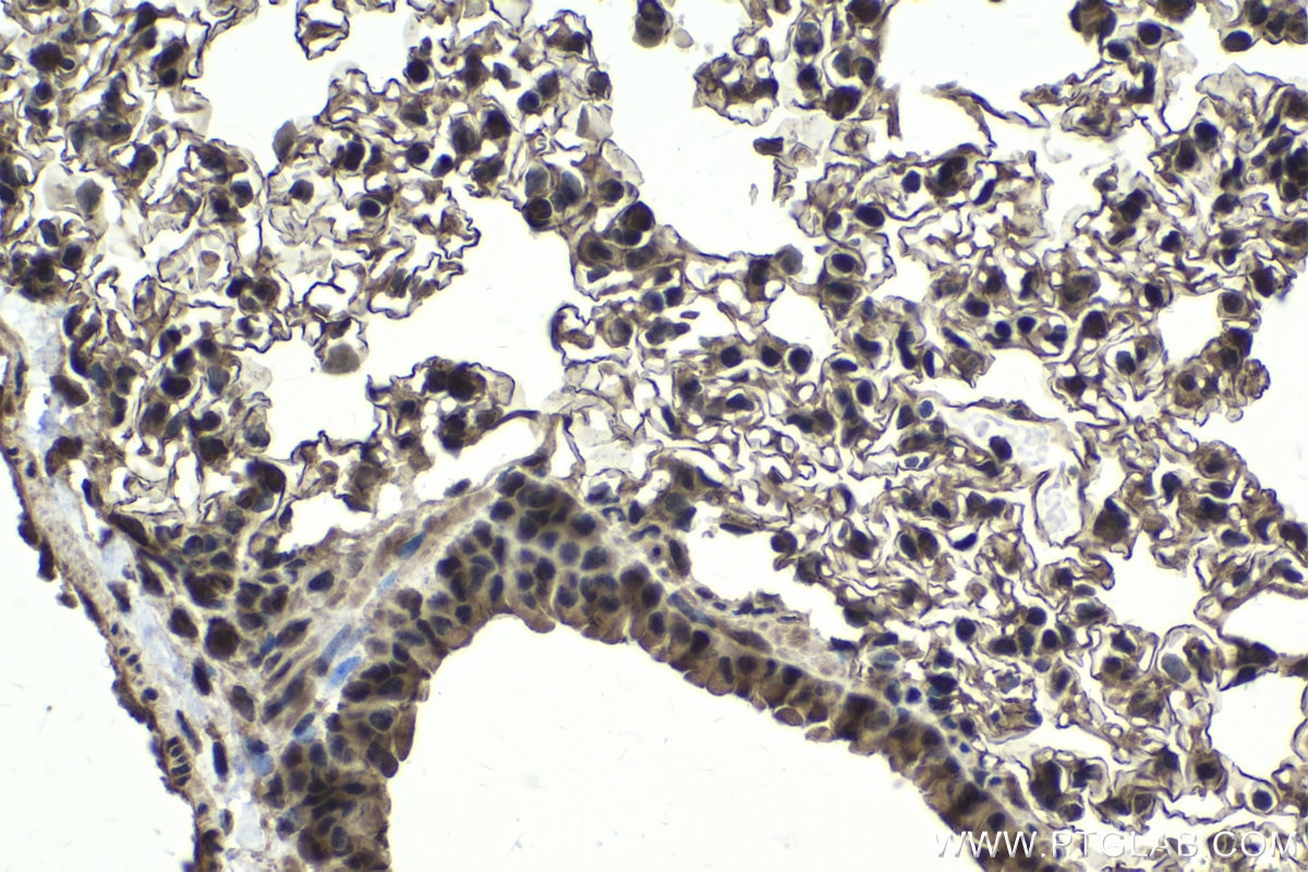Immunohistochemical analysis of paraffin-embedded mouse lung tissue slide using KHC1712 (NFATC2 IHC Kit).